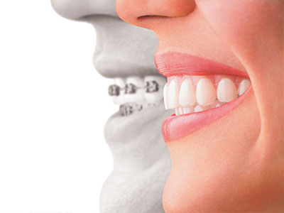 Waterford Dental Health | Implant Dentistry, Crowns and Fluoride Treatment